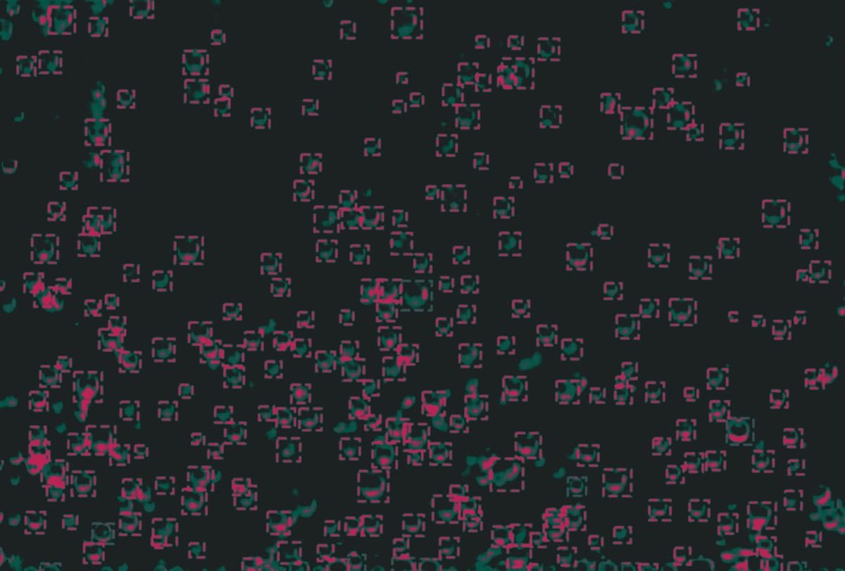 [Computer Vision: Bubbles]